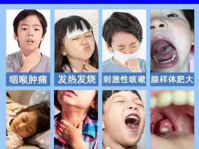 扁桃体反复发炎是如何引起的孩子怕打针如何治疗？