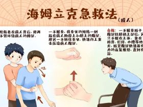 为什么海姆立克急救法可以将异物从气管里挤出？